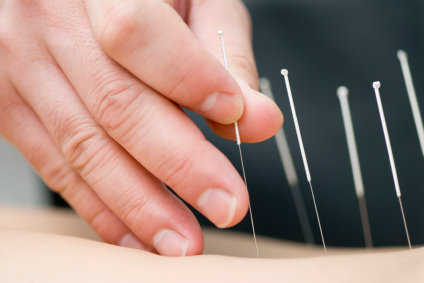 Acupuncture Practitioner